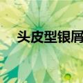 头皮型银屑病（关于头皮型银屑病简介）