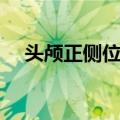 头颅正侧位片（关于头颅正侧位片简介）