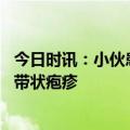 今日时讯：小伙患白血病腰痛以为是阳康后遗症 新冠病毒与带状疱疹