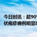 今日时讯：超90%成人体内有水痘带状疱疹病毒 医生近期带状疱疹病例明显增加