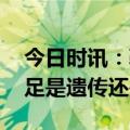 今日时讯：鞋底磨损异常或是疾病信号 扁平足是遗传还是后天