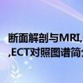 断面解剖与MRI,CT,ECT对照图谱（关于断面解剖与MRI,CT,ECT对照图谱简介）