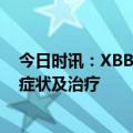 今日时讯：XBB.1.16本土病例一周内翻番 xbb毒株的主要症状及治疗