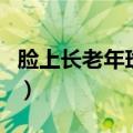 脸上长老年斑是什么原因（是什么原因造成的）