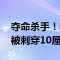 夺命杀手！电动自行车安装遮阳伞 女子脸部被刺穿10厘米