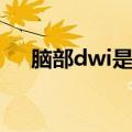 脑部dwi是什么检查（dwi是什么检查）